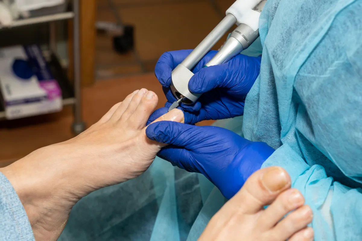 Quiropedia clínica vs. pedicura estética: por qué no son lo mismo